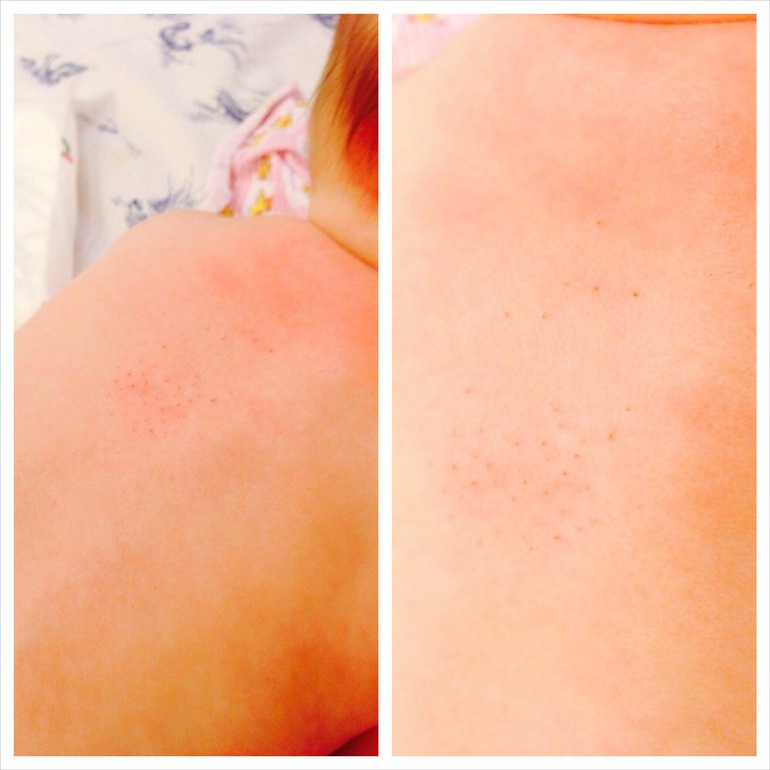 А напишу ка я Вам про Щекотун...