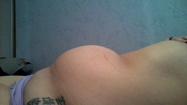 70