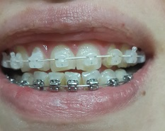 9 месяцев спустя