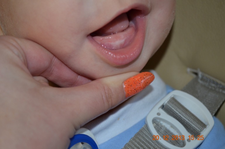 Зубы это или нет?