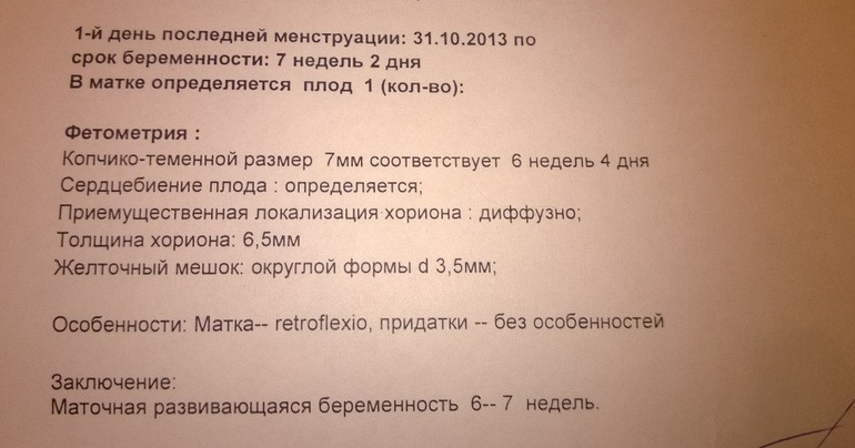 Наше первое УЗИ!))