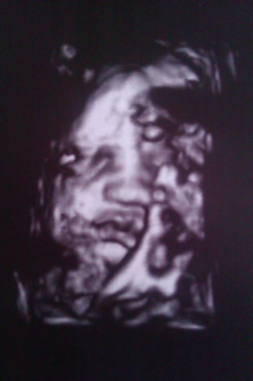 встреча с Гришей:)