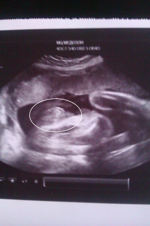 встреча с Гришей:)