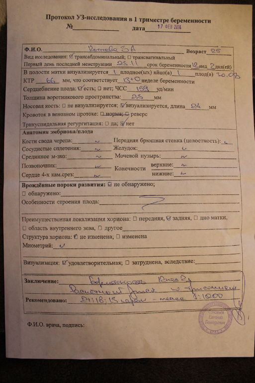 УЗИ. 12 неделек.