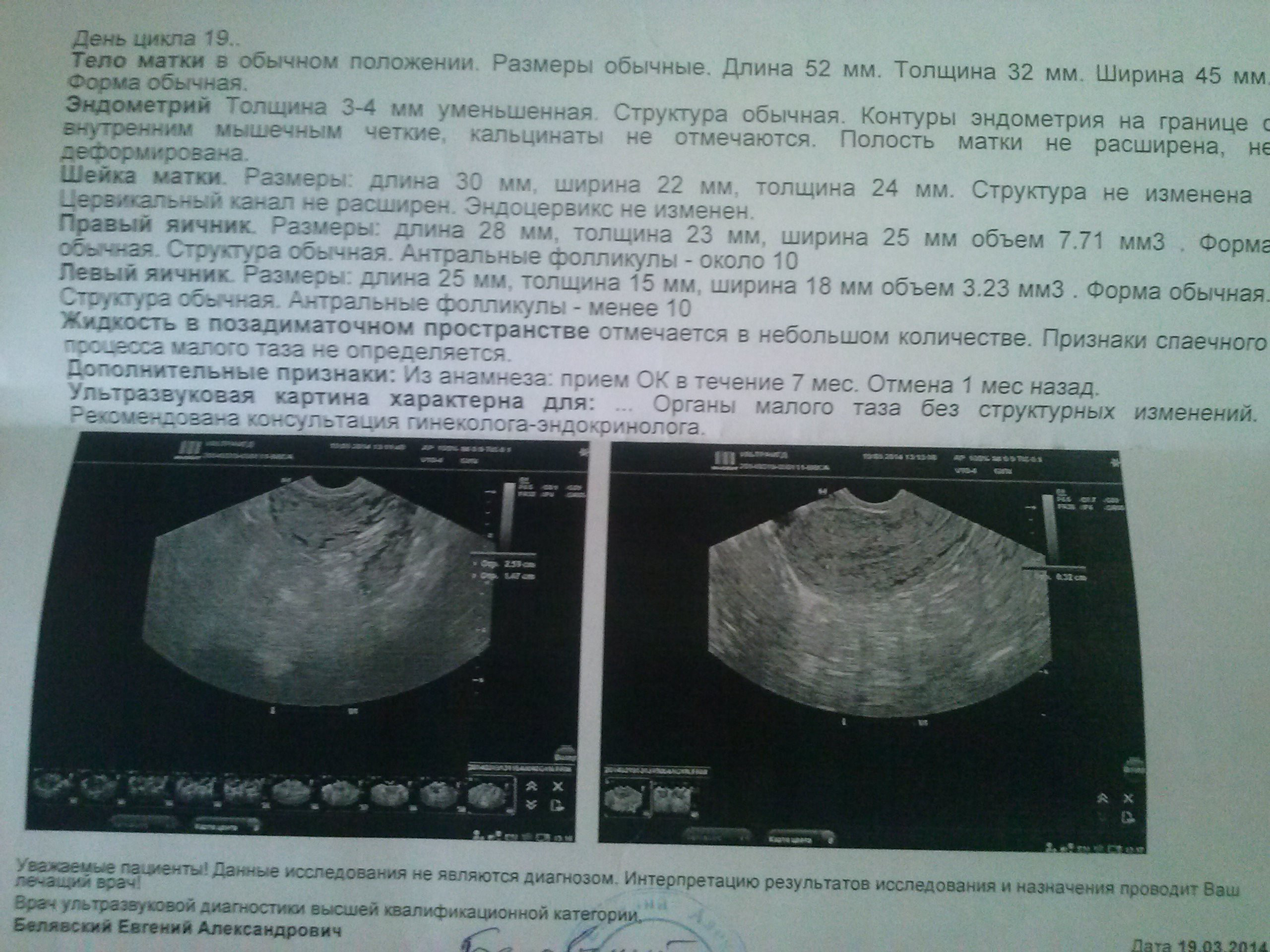 Помогите пожалуйста(((((((