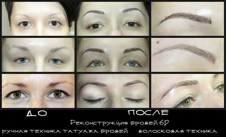 Реконструкция бровей 6D