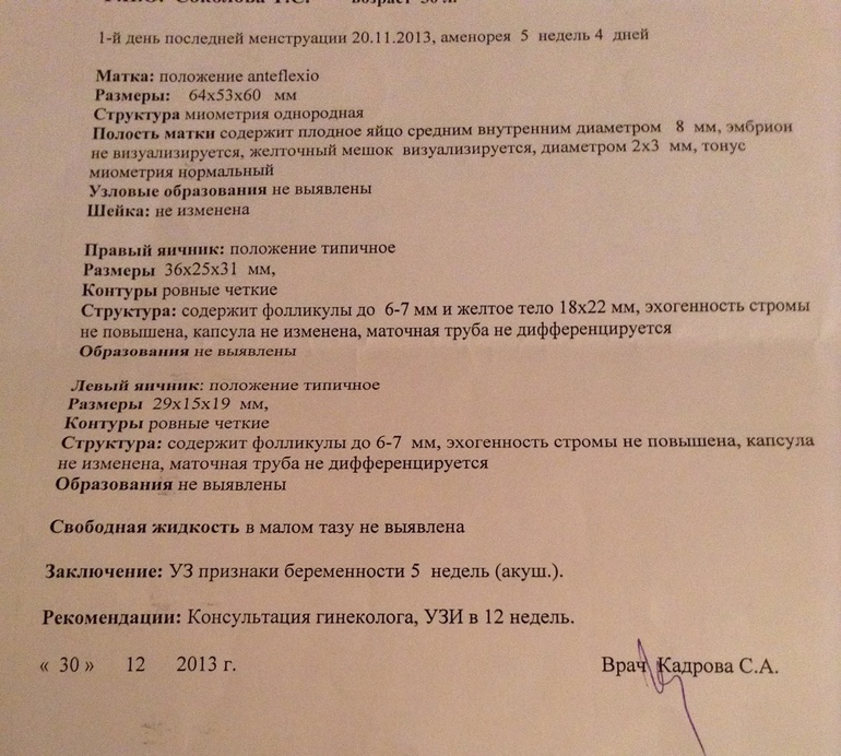Девочки я чихаю на вас)))