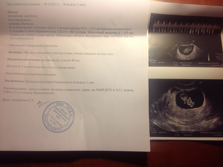 Сегодня получше