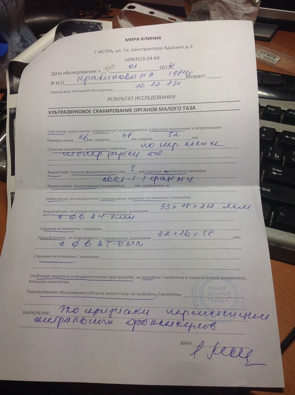 Узи