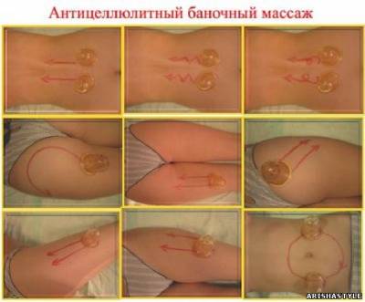 Антицеллюлитный массаж банками в домашних условиях!!