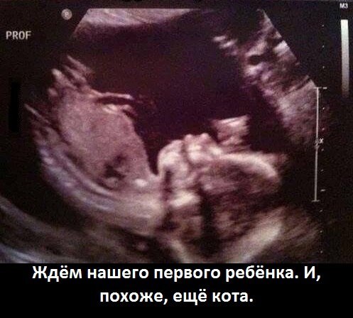 Девочки отвлекитесь не много))))