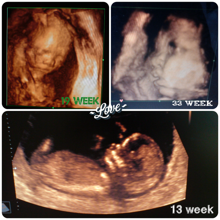 my baby