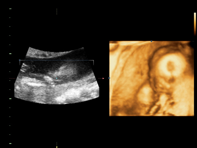 Ура! У нас в домике МАЛЬЧИК!