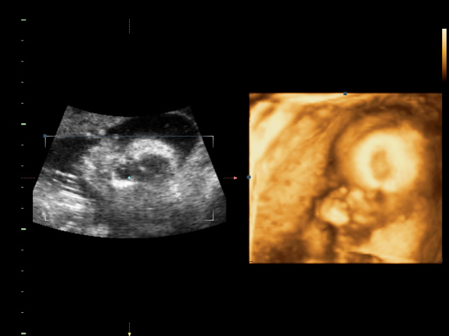 Ура! У нас в домике МАЛЬЧИК!