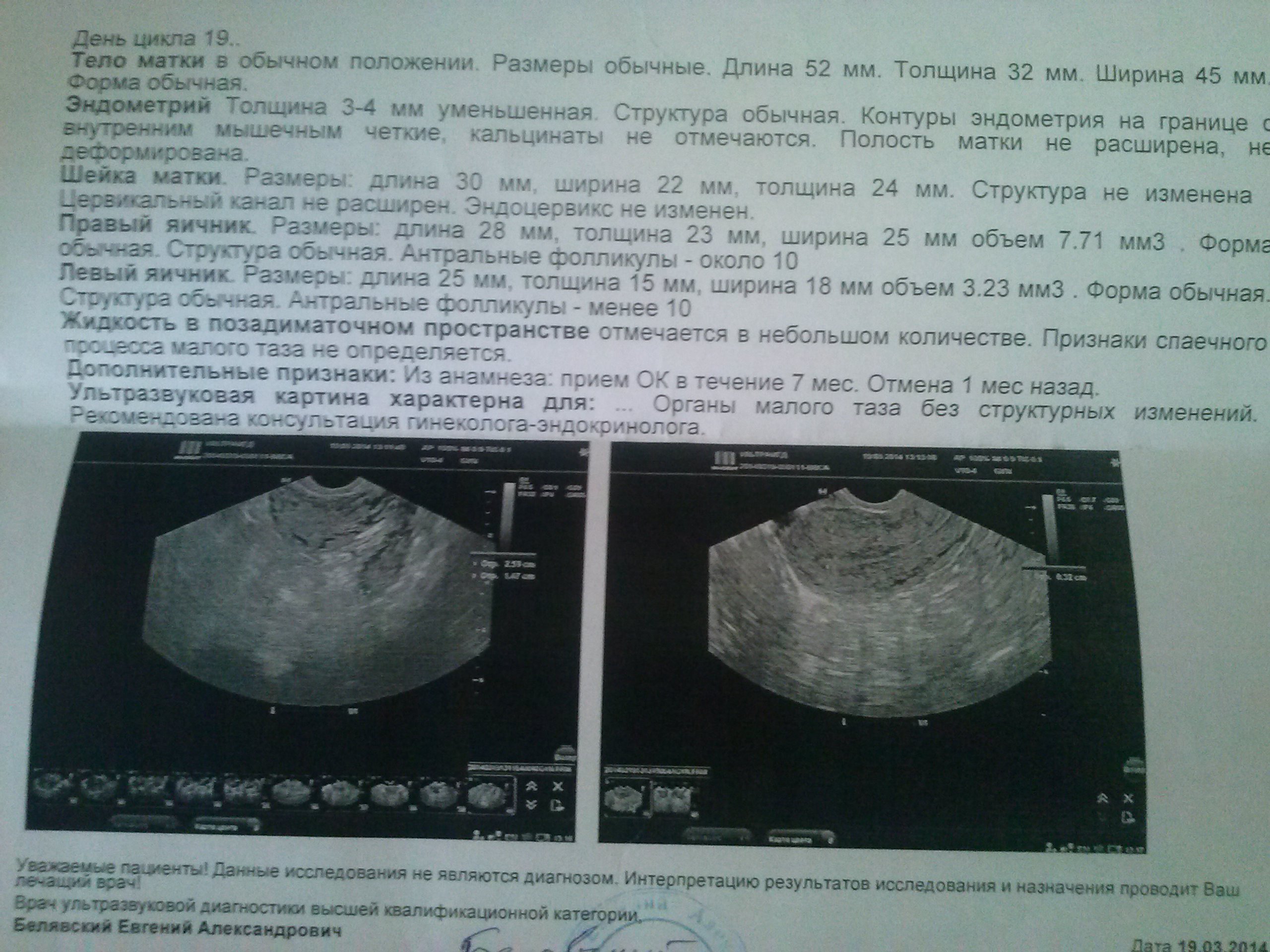 Помогите пожалуйста(((((((