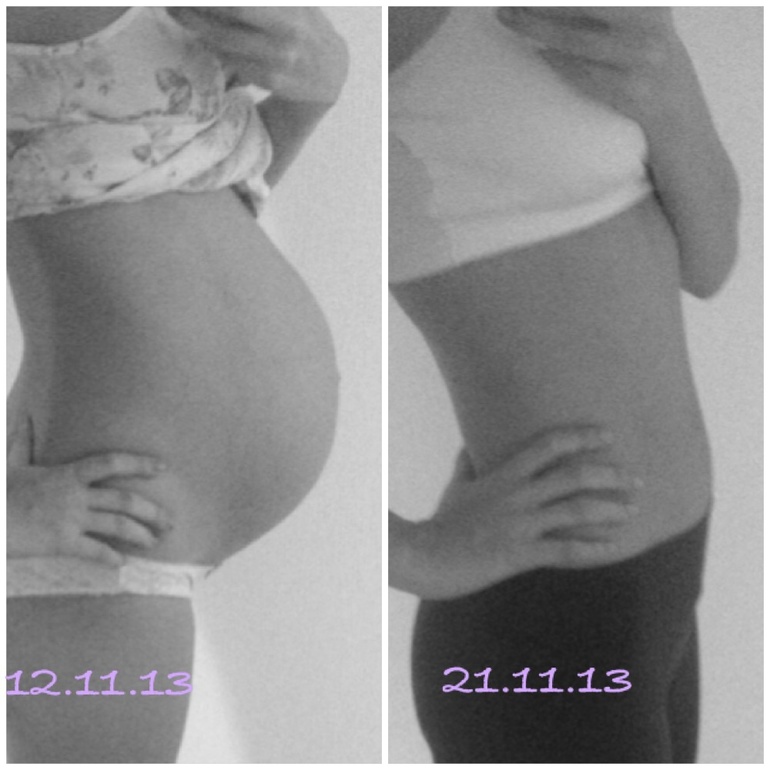 Беременность в картинках