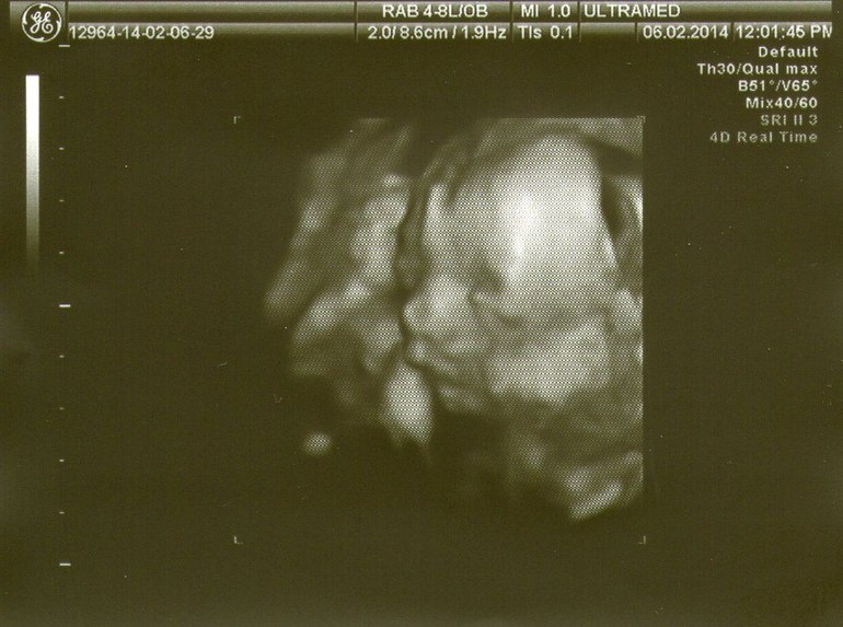 Узи!!!!!!21 нед