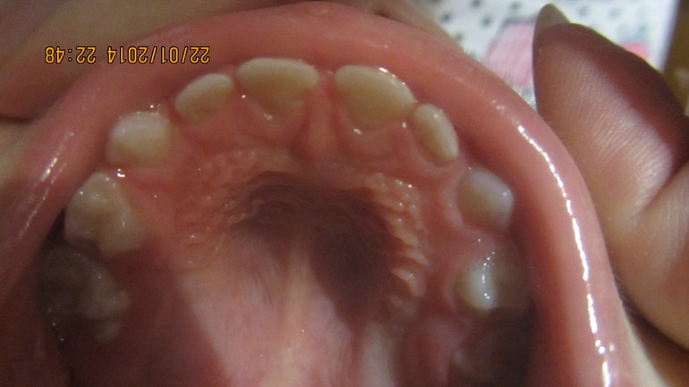 Как лечить?