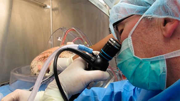 Ученые впервые вырастили человеческие легкие в лаборатории