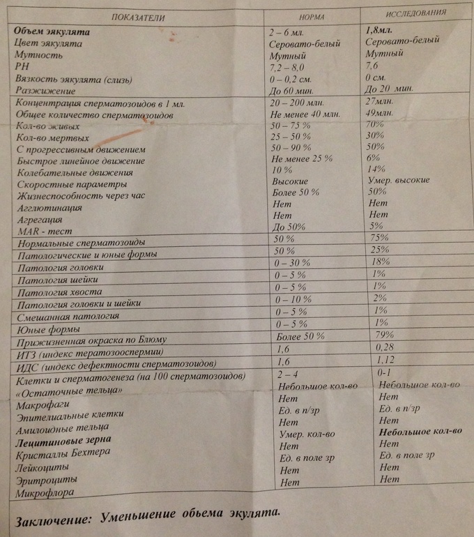 Спермограмма итз идс