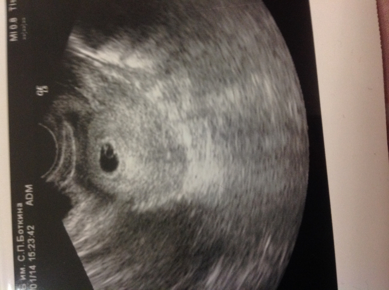 Наконец-то нас четко увидели!!!)