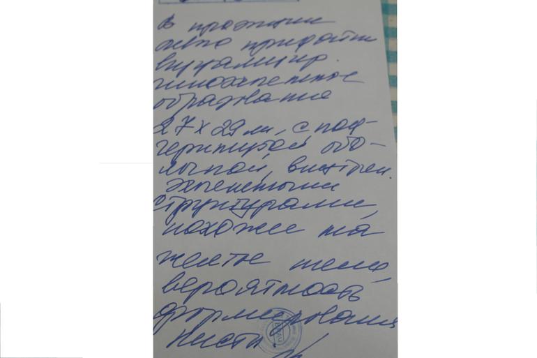 УЗИ после ХГЧ