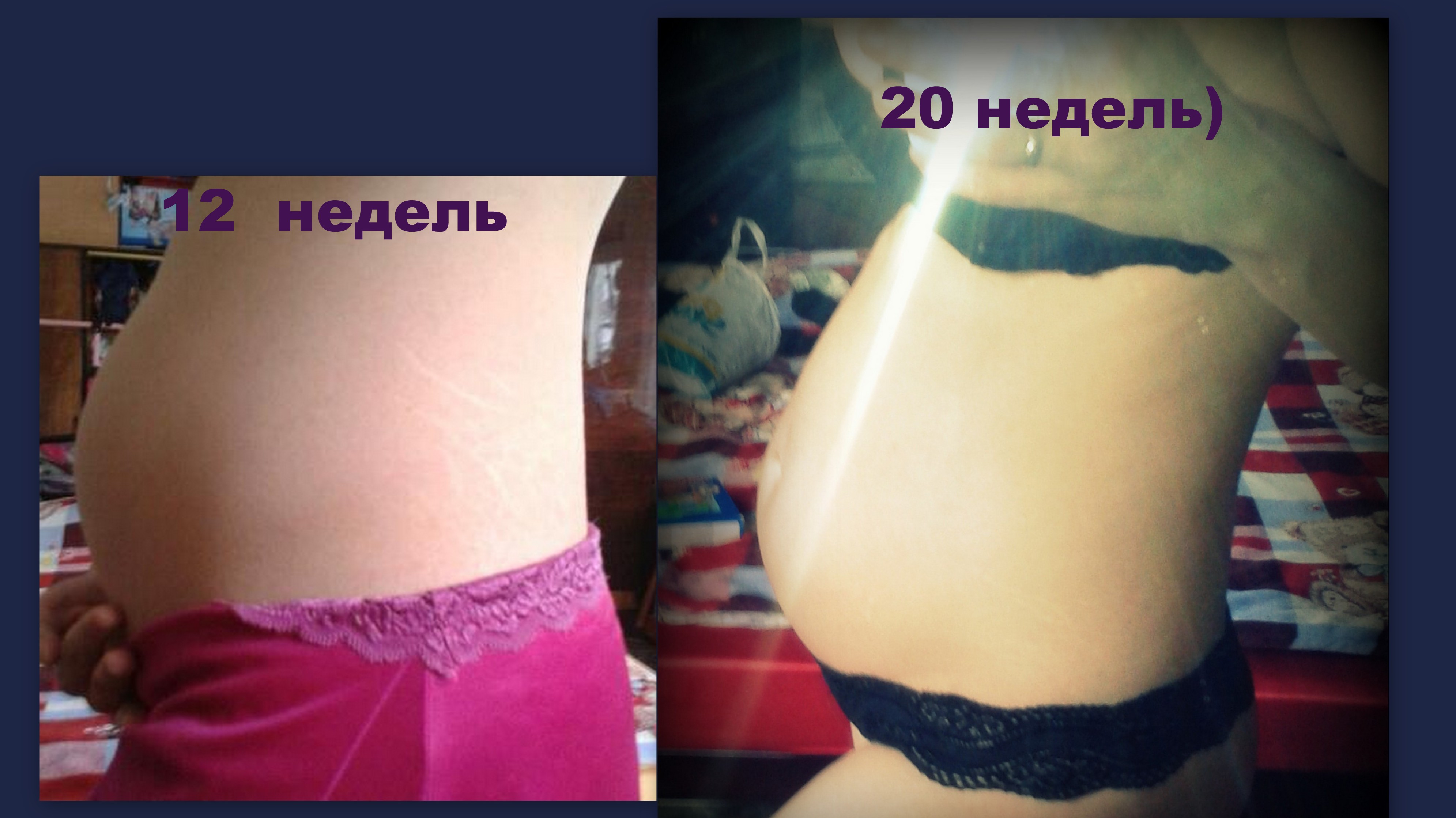 а вот и мы в 20 неделек)