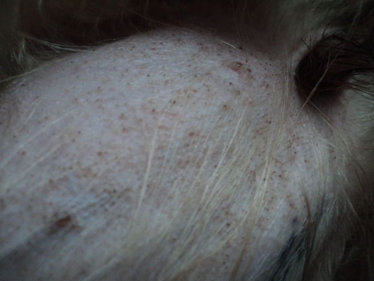 сыпь у йорка