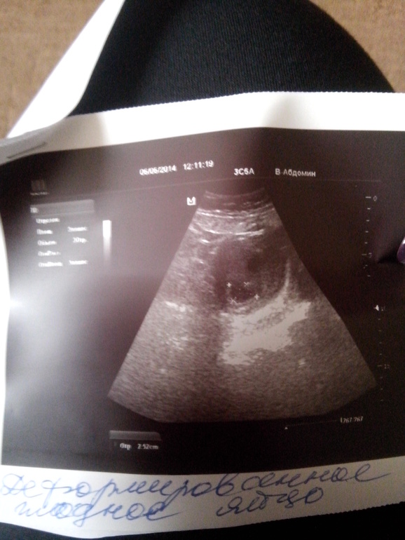 Девочки, помогите разобраться((((