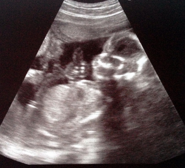 Мамита грустит.