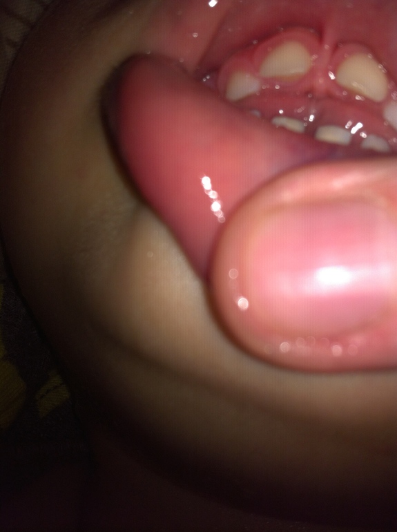 У нас уже неправильный прикус?