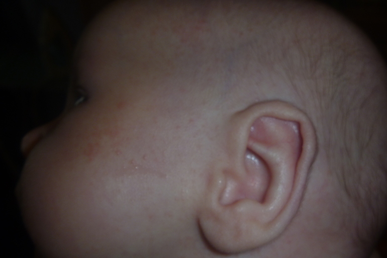 подскажите что это аллергия или что другое????