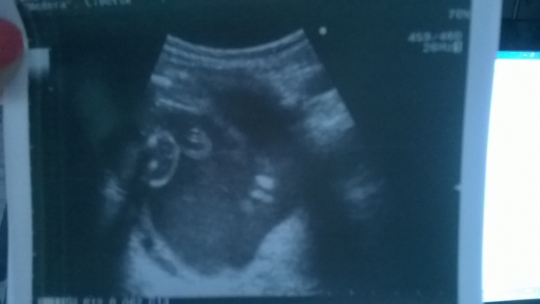 помогите разобраться!