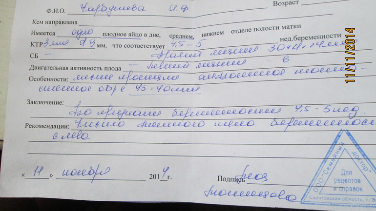узи на 5-6 неделе беременности фото онлайн узи на 5-6 неделе беременности фото