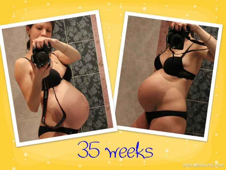 Узи в роддоме 36,3 неделек