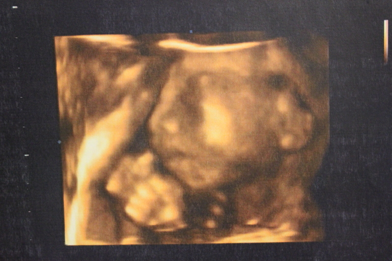 УРРРРАААААААААА!!!!!!!!!!! УЗИ в 21 неделю)))))))