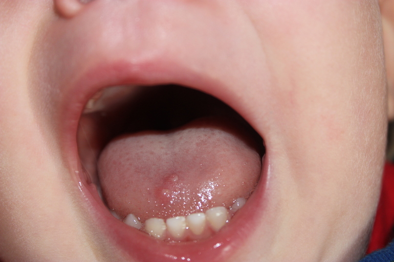 что это? фото