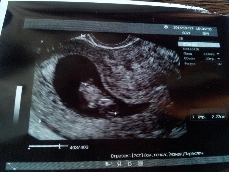 Всё-таки у нас все хорошо!!!))))))