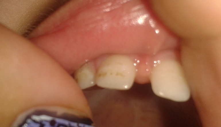 Горизонтальные полоски