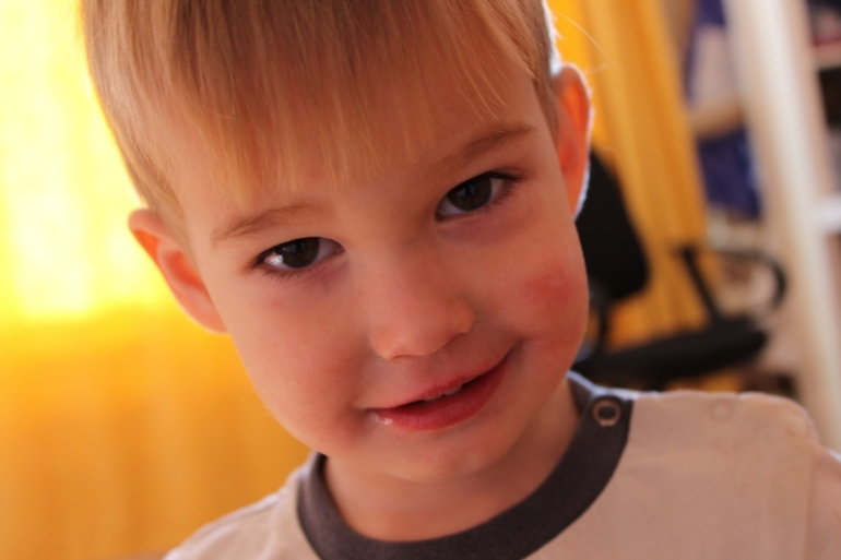 Болеет котёнок=(((