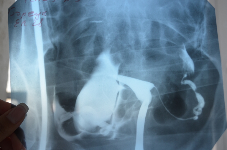 Результаты МСГ