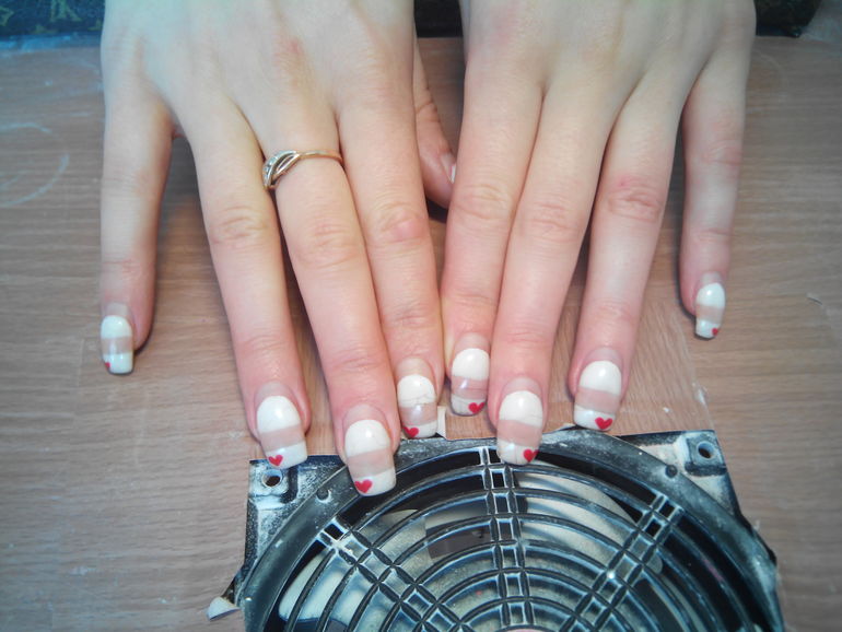 Перенаращивание