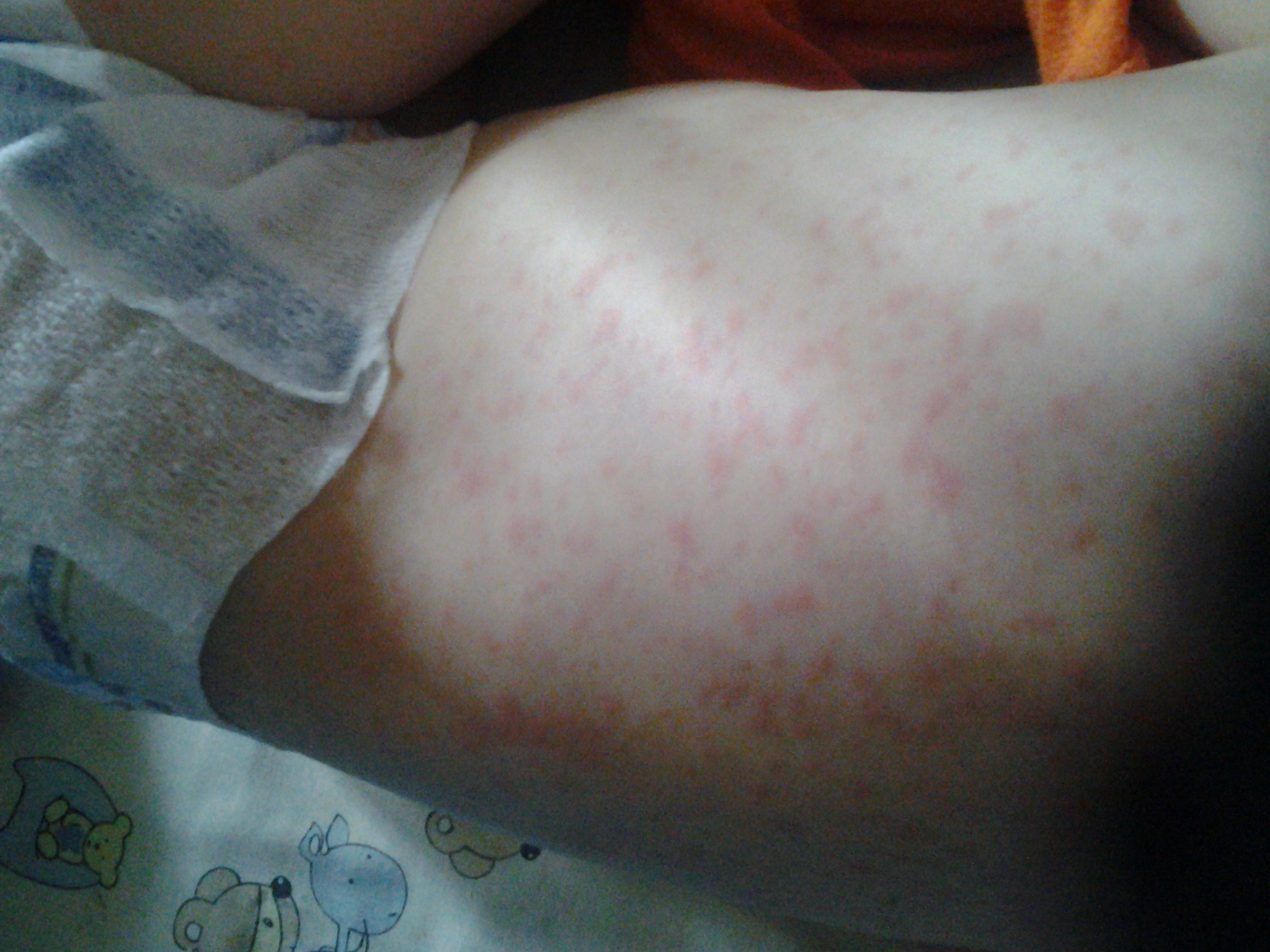 Опять болеем(((