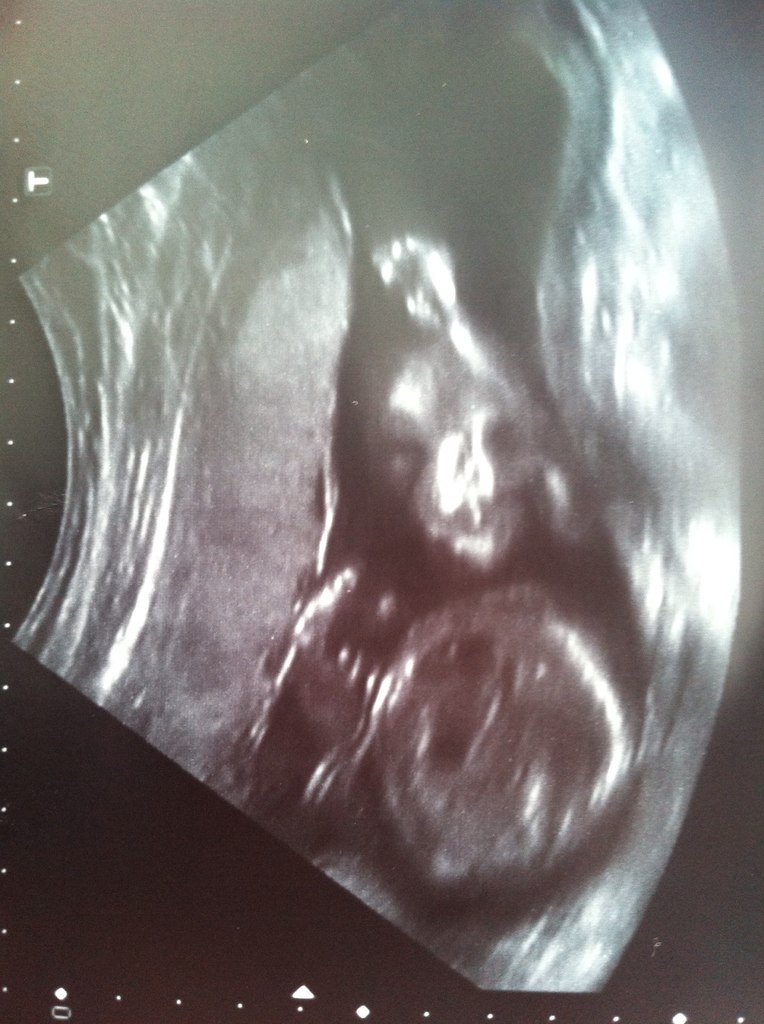 хихихи!! у нас мальчик)))))))))