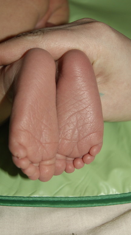 Тимкины пяточки)))