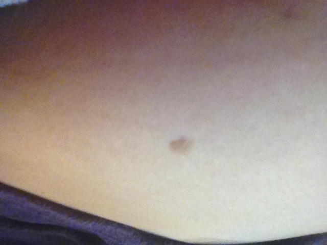 Девочки кто в курсе что это может быть?