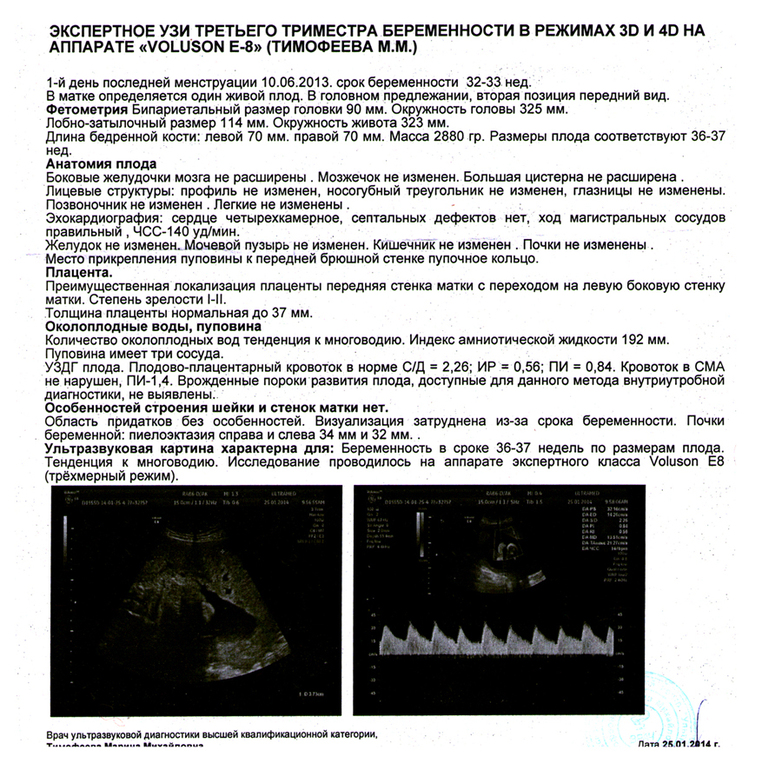 Третье УЗИ!!!!! Начинать волноваться?