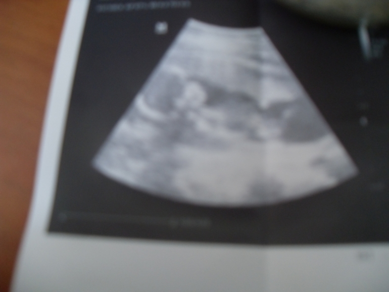 Помогите определить пол!(врач сказал большой процент девочка)так ли это?