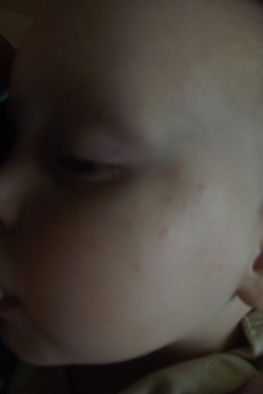 Редко, но метко