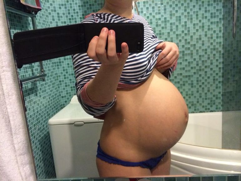 подскажите,опустился пузик или нет?